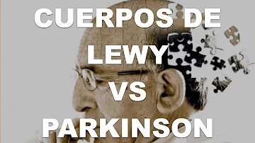 ¿Todos los enfermos de Parkinson tienen cuerpos de Lewy?