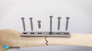 3D Depth Gauge