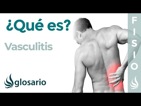 Vídeo: Vasculitis: Causas, Síntomas Y Tratamiento De La Vasculitis