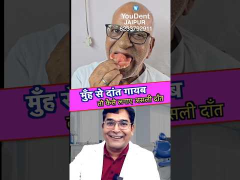 इम प ल ट लगव न ह क न स नकल द त अच छ ह त ह Full Mouth Dental Implant In INDIA