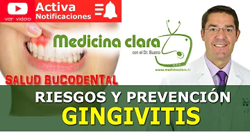 ¿Puede la gingivitis afectar a otras partes del cuerpo?
