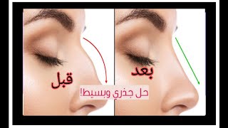 تصغير الانف بدون عمليات تجميل ولا كنتور?هنشوف النتيجه ف وقتها وهم وهم