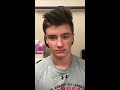 Post Op Endoscopic Sinus&Septoplasty on a 16year old-doing well