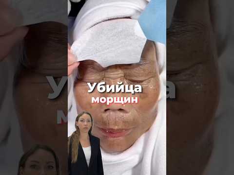 Быстрый способ избавиться от морщин #мощины #нити #коллаген #губымосква #косметологмосква