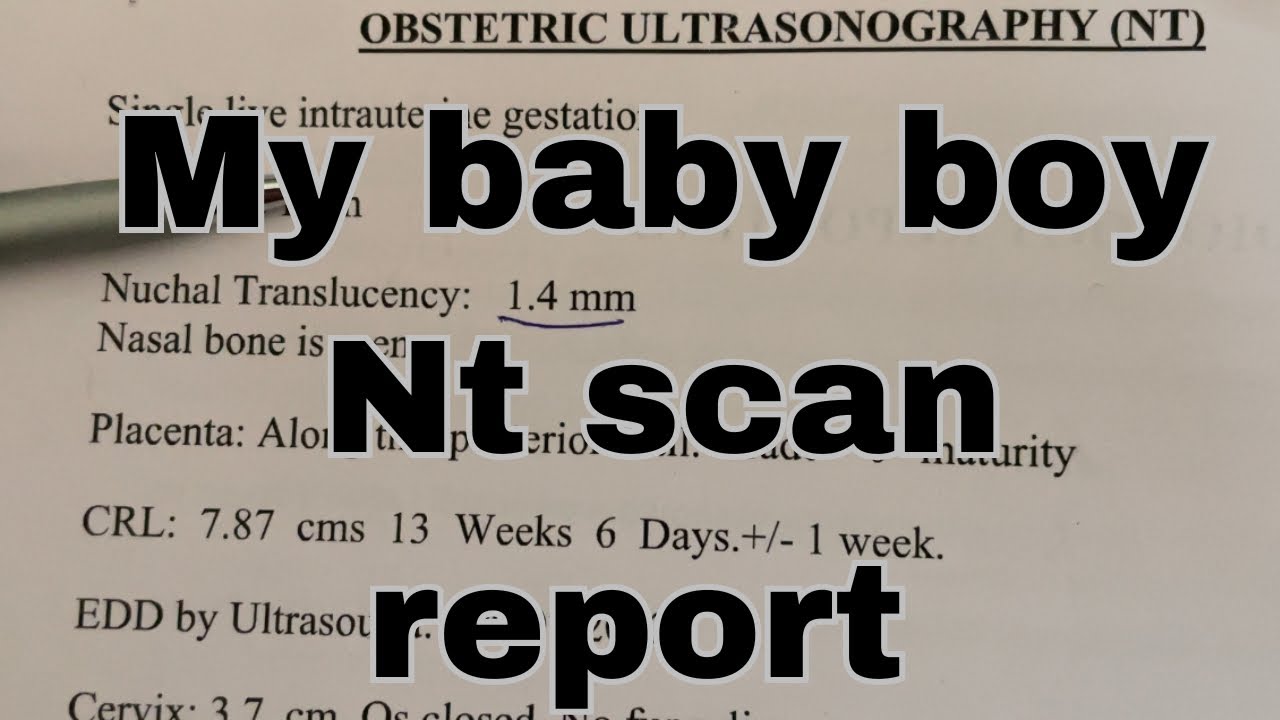 Baby Boy Nt Scan Report pregnancy trending viral youtube scan baby-boy-nt-scan-report-pregnancy-trending-viral-youtube-scan