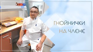 👉 Гнойнички на члене. Клинический случай №90