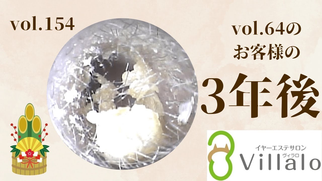 耳掃除動画 vol.154「vol.64のお客様の3年後」