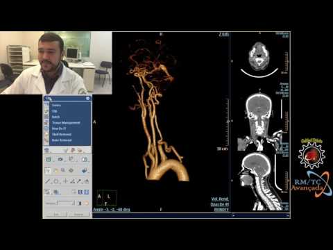 RECONTRUÇÃO 3D - DEFININDO CORES DISTINTAS NO VR