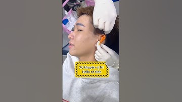 Xỏ khuyên tai vị trí Helix cá tính, an toàn tại thế giới xỏ khuyên TinyBox