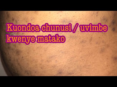 Video: Jinsi Ya Kuondoa Uzito Kutoka Kwenye Matako