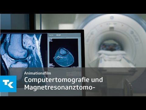 Video: Neue Entwicklungen Bei Arthrose. Geschlechtsunterschiede Bei Biomarkern Auf Der Basis Der Magnetresonanztomographie Und Bei Solchen Des Gelenkstoffwechsels