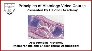 Osteogenesis Histology (Membranous and Endochondral Ossification) [Bone Histology Part 3 of 3]