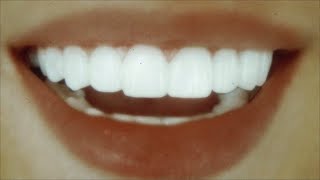 здоровые белоснежные зубы + прикус и десна ✧ саблиминал 432 гц (rus)