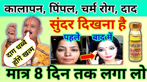 दाग धब्बे पिंपल चर्म रोग दाद | सुंदर दिखना है तो ये उपाय करो | pradeep Mishra ji charm rog ke upay
