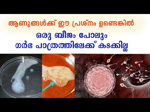 പുരുഷനു ഈ പ്രശ്നം ഉണ്ടെങ്കില്‍ ബീജങ്ങള്‍  യൂട്രസില്‍ കടക്കില്ല  | Delayed Liquefaction of Semen |