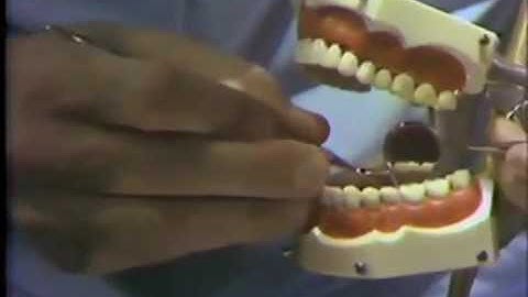 Refining The Preparation: Application of Hand Instruments