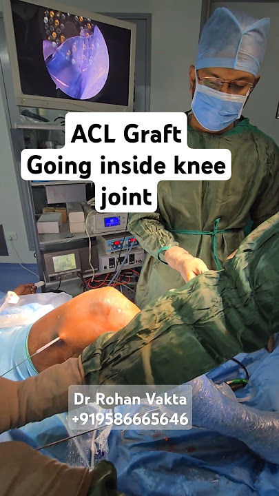 ACL Graft #aclrecovery #aclsurgeryrecovery #acltreatment #acl
