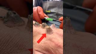 Barnacles grew on his arm 😲