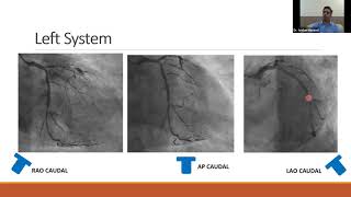 Webinar 10, Coronary Angiogram ( Discussion & Decision making )