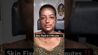 Skin Problem Ka Ilaaj 2 Minutes Mei | Mridul Madhok