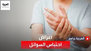 تعرف على أعراض احتباس السوائل في الجسم