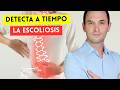 Escoliosis en niños, una realidad genética: Cómo detectarla en casa