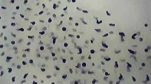 time-lapse: frog spawn