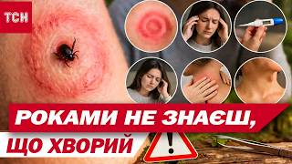 Журналістка Тсн Заражена Хворобою Лайма Які Результати Піврічного Лікування?