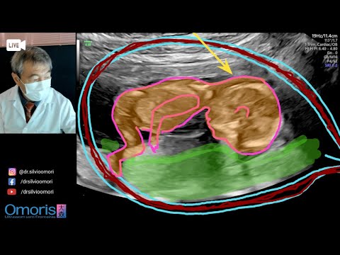 Video: Kus asuvad kloroplastide küsitluses klorofülli molekulid?