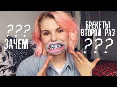 Как целоваться/кушать/жить с брекетами?