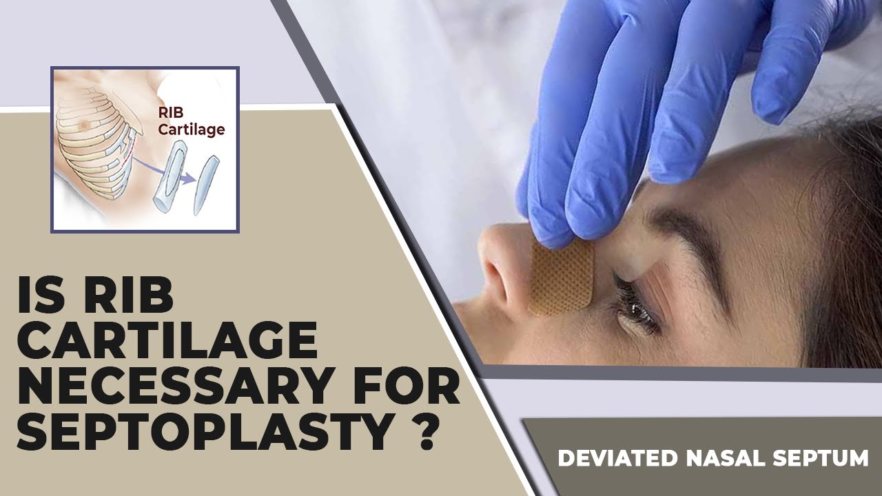 Septoplasty के लिए Rib Cartilage जरूरी है क्या? How to Perform