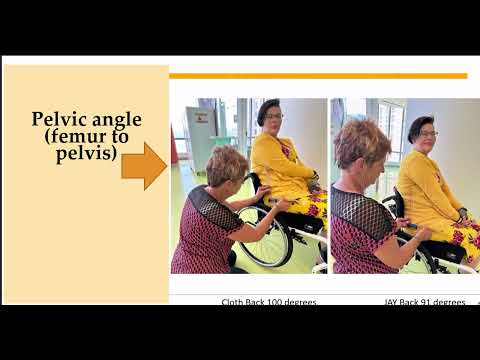 Clinical Evidence for the Support of Spinal Curves in Wheelchair Seating