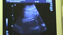 Ultrasound at 27 Weeks Pregnant!