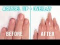 How To: Tip and Overlay with AcryGel