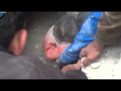 ნეპალში ნანგრევებში ბავშვი სიკვდილისგან იხსნეს