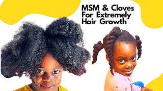 MSM And  Cloves Scalp Treatment For  Extreme Hair Growth #sweetpely #msm