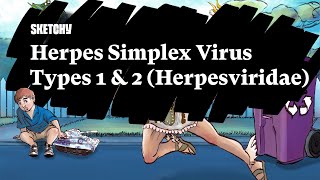 Herpes Simplex Virus Types 1 & 2 (Herpesviridae) - Part 1 | Sketchy Medical | USMLE Step 1