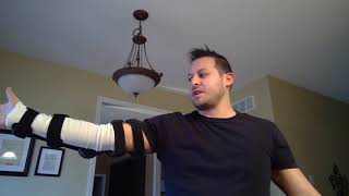 Distal Bicep Tendon Rupture Surgery Update