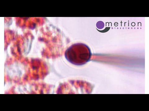 Demonstration of Endo-Lysosomal Patch Clamp Technique