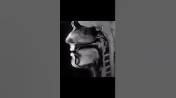 MRI scan shows what mouth looks like when people speak