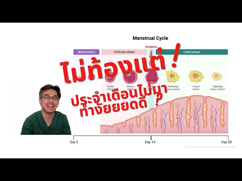 ขาดประจําเดือน ( Amenorrhea  โดยไม่ได้ตั้งครรภ์ )  รพ.รามา