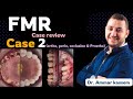 FMR case 2 review || Dr. Ammar kassem