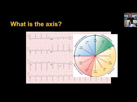 A to Zs of EKGs: An Overview – October 1, 2021