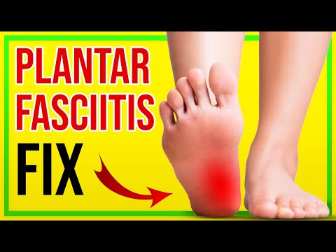 Video: Plantar Fasciitis Strækker Sig For At Lindre Hælen