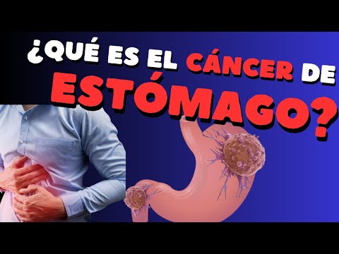 Vídeo: Què és el terme mèdic de la gastrectomia?