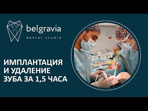 👨‍⚕️ Имплантация и удаление зуба за 1,5 часа