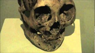 The Largest Elongated Heads In The World