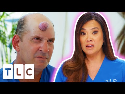 Dr Lee Worried This Man's Bump Is About To Explode! | Dr Pimple Popper