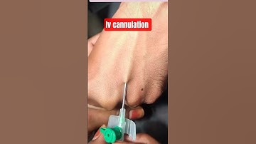 iv cannula kaise lagaye #youtubeshorts #doctor #nursing #shortvideo #viral #shorts