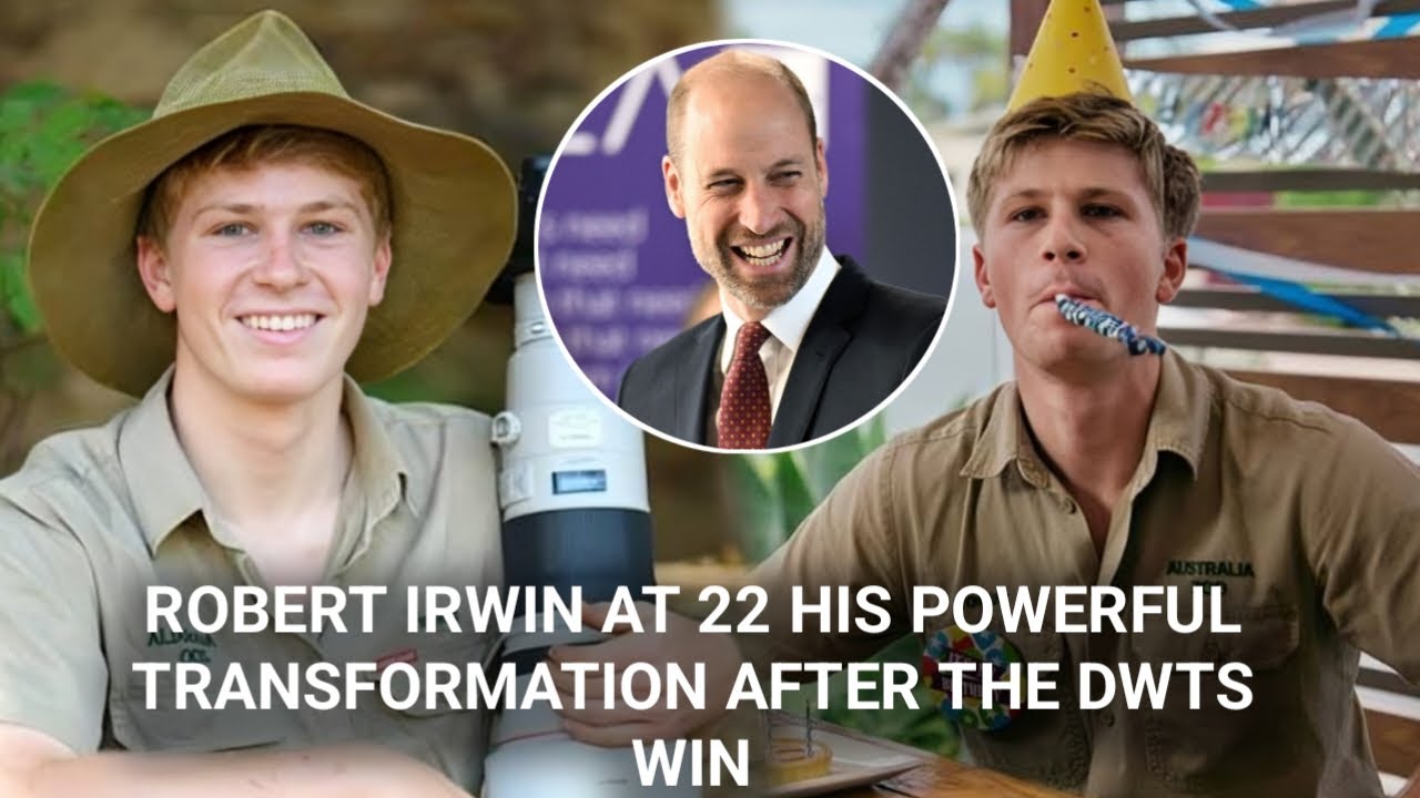 Robert Irwin at 22: His Powerful Transformation After the DWTS Win ...